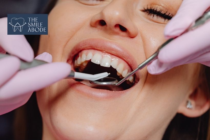 Digital smile design consultation at dental clinic in Gurugram