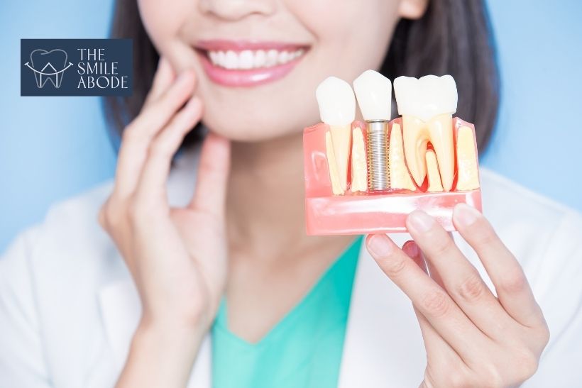 Comparison diagram of dental implant bridge and denture for missing teeth, Gurugram