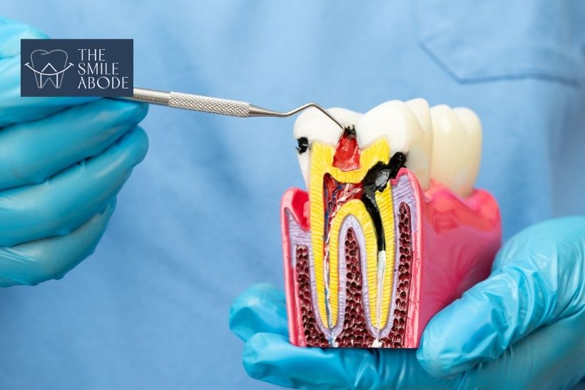 Root canal specialist using a microscope for precision endodontic treatment in Gurugram