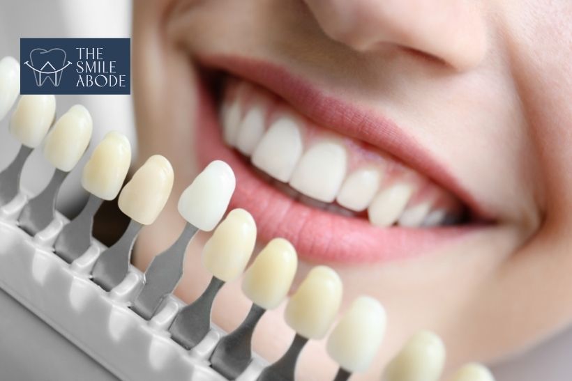 Before and after Zoom teeth whitening results at The Smile Abode, Gurugram