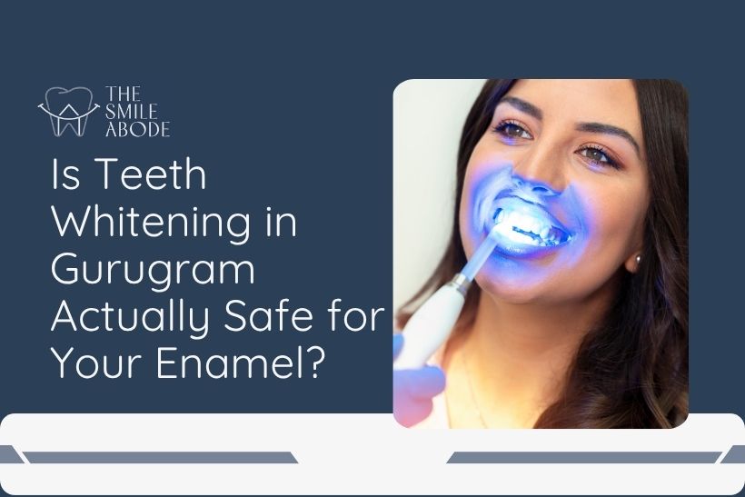 Professional Zoom teeth whitening treatment at The Smile Abode, Gurugram, Sector 51